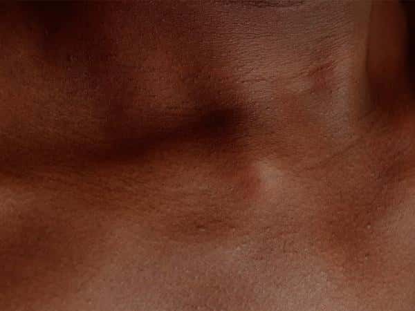 Thackray Lates: No Filter - Love Letters to Melanin
