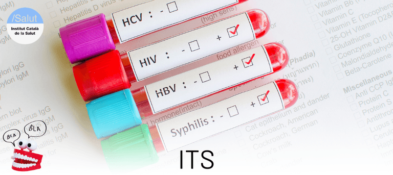 Infeccions de transmissió sexual