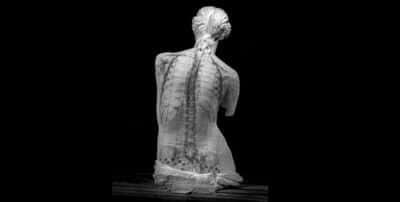 Columna