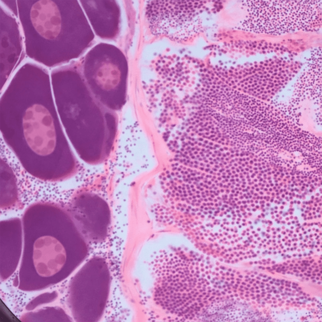 Peces feminizados: medioambiente y sexo submarino