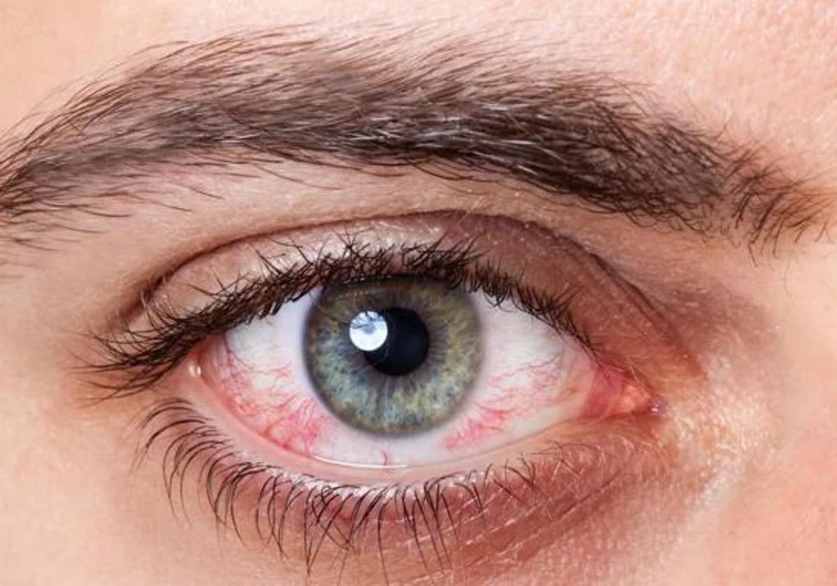 Revisi贸n gratuita de tensi贸n ocular